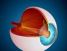 Image result for Uveitis Eye Disease