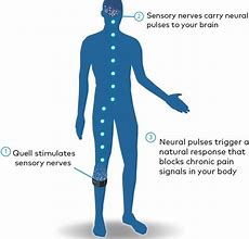 Image result for Quell Shooting System