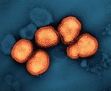 Image result for Influenzavirus A