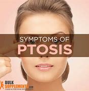 Image result for Ptosis Nerve Damage