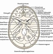 Image result for Extra-Axial Posterior Fossa Mass