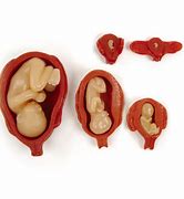 Image result for 15 Weeks Uterus