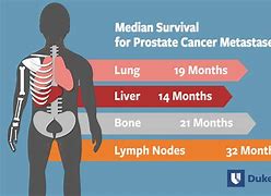 Image result for Cancer Bone Metastasis