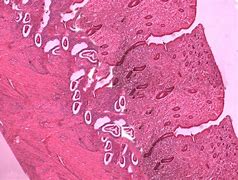 Image result for Uteres Histology