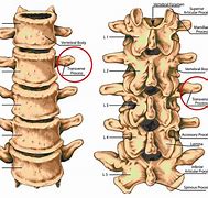 Image result for Transverse Spine