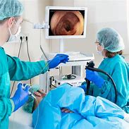 Image result for Lower GI Endoscopy