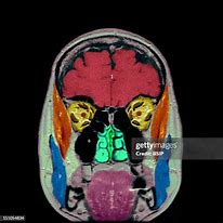 Image result for musculo temporal function