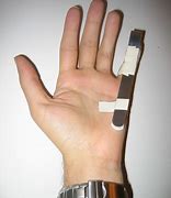 Image result for Smashed Tip of Pinky Finger