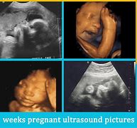 Image result for 31 Week Baby