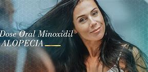 Image result for Low Dose Minoxidil for Hair Loss