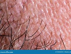 Image result for Macro Skin Pores