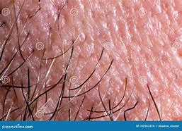 Image result for Human Skin Pores