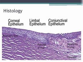 Image result for Limbus Cornea