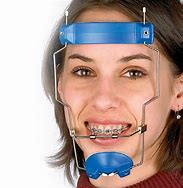 Image result for Orthodontic Headgear