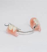 Image result for Partial Denture Clasps