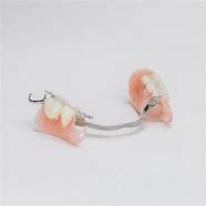 Image result for partial denture clasps materials