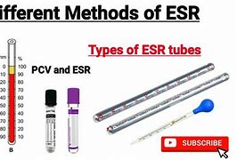 Image result for ESR Procedure