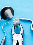 Image result for Tooth Extraction Painless