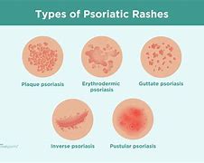 Image result for Skin Rash with Pustules