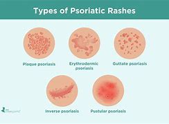 Image result for Rash Diagnosis