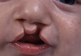 Image result for Kerb Lip