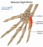 Image result for Abductor Digiti Minimi Brevis