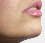 Image result for Female Hair On Chin