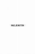 Image result for Skleritis