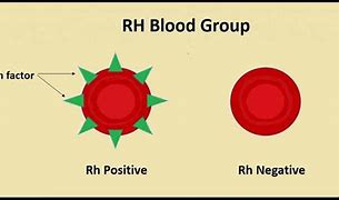 Image result for RH Blood Group System