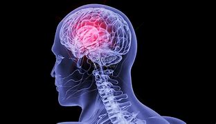 Image result for Brain Cancer Photo Human