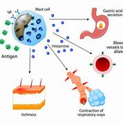 Image result for Post Pico Genesis Histamine Reaction