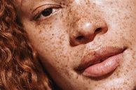 Image result for Interesting Faces Freckles