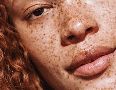 Image result for Ace Freckles