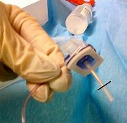 Image result for Needle Port in Hand