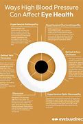 Image result for High Blood Pressure Eye Symptoms