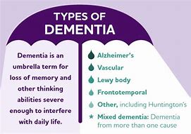 Image result for Dementia Albiro