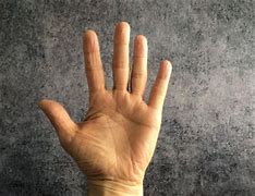 Image result for Fifth Digit Finger