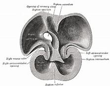 Image result for Septum Secundum