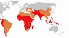 Image result for Epidemic Typhus