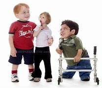 Image result for Kids with Dwarfism