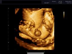 Image result for Baby Scan 3D 4D