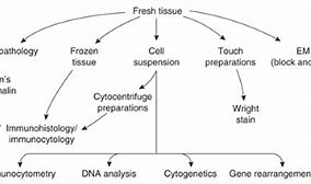 Image result for Lymph Node Biopsy