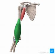 Image result for Selective Catheter Placement From Brachial Approach