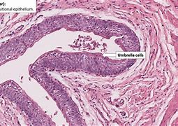 Image result for Ureter Histology Slides Labeled