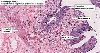 Image result for Normal Bladder