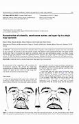 Image result for Columella Septum