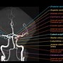 Image result for CT Angiogram Brain Anatomy