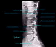 Image result for Lumbar Spine Side View