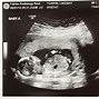 Image result for 16 Weeks Baby in Womb