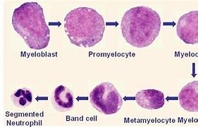 Image result for Neutrophil Granules